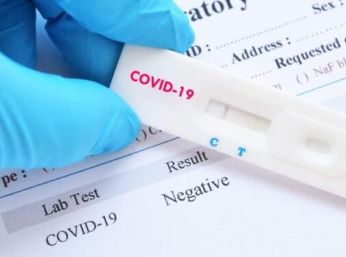 Экспресc тест на антиген к коронавирусу SARS-CoV-2
