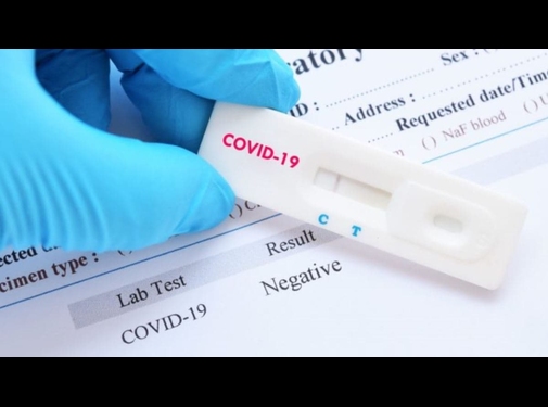 Експрес тест на антиген до коронавірусу SARS-CoV-2